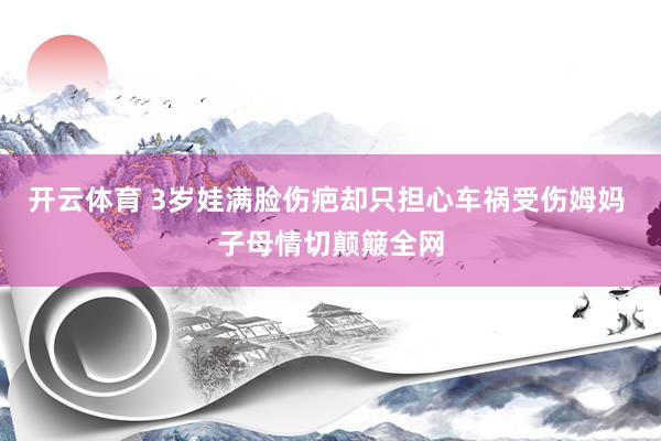 开云体育 3岁娃满脸伤疤却只担心车祸受伤姆妈 子母情切颠簸全网